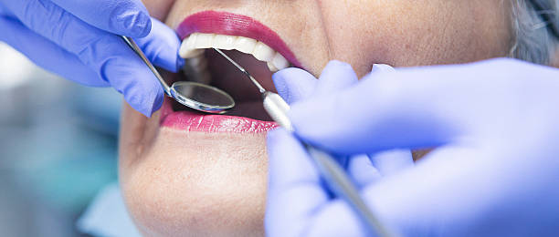 Best Broken or Chipped Tooth Repair in Bellevue, MI
